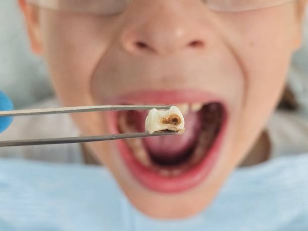 Best Weekend Emergency Dentist in Jonesborough, TN
